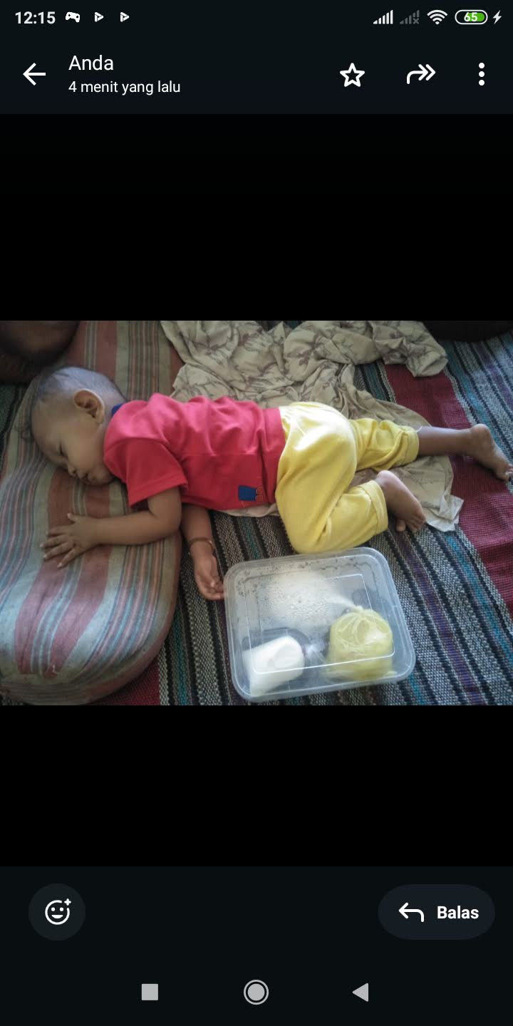 Pemberian PMT stunting