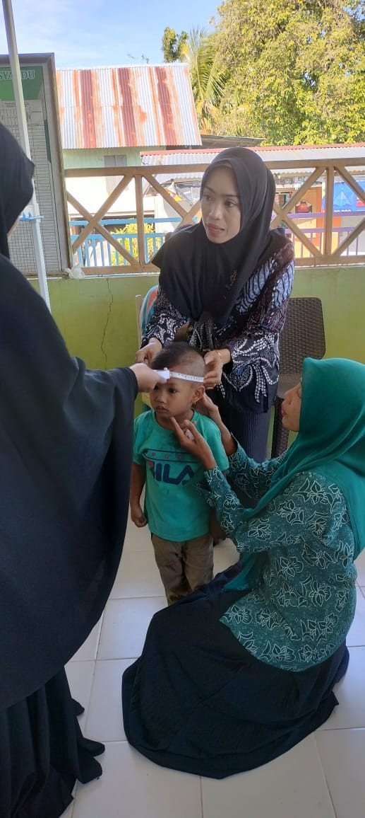 Pengukuran lingkar kepala