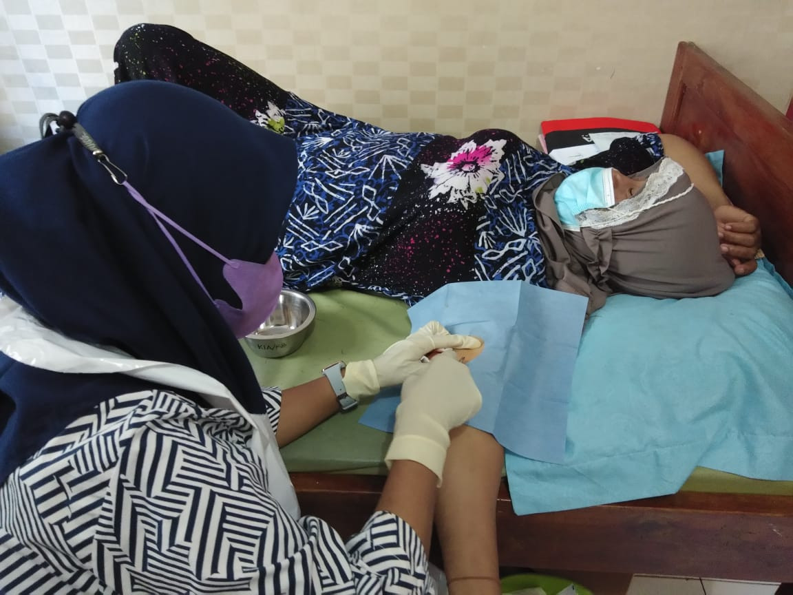 Pelayanan kontrasepsi jangka panjang (IMPLAN)